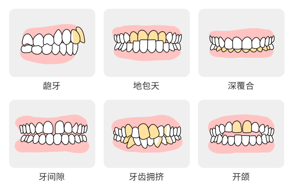 k8凯发牙齿修复一般价格牙齿美白牙齿全瓷贴面价格湖北户口注意！刚刚通报！缺牙、牙