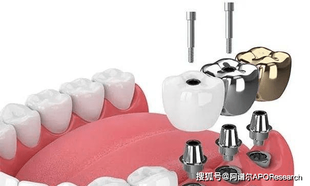 k8凯发全球与中国种植牙市场：增长趋势、竞争格局与前景展望