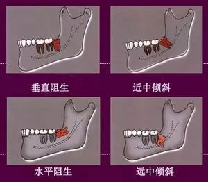 k8凯发，40元和20000元！这笔账你可要算清楚！